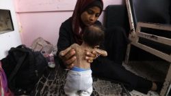 A Palestinian mother with her malnourished two-month-old daughter