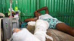 Überlebender des Massakers von Pont-Sondé