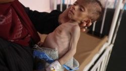 Hungerndes Kleinkind im Gazastreifen