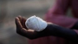 Feriti e sfollati in Sudan