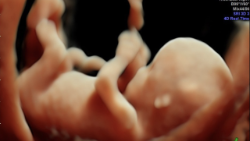 Dziecko w 12 tygodniu życia